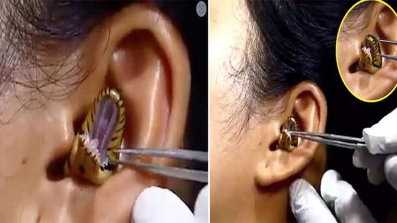 Terrifying Encounter: Snake Emerges from Woman’s Ear Leaves Viewers in Fear